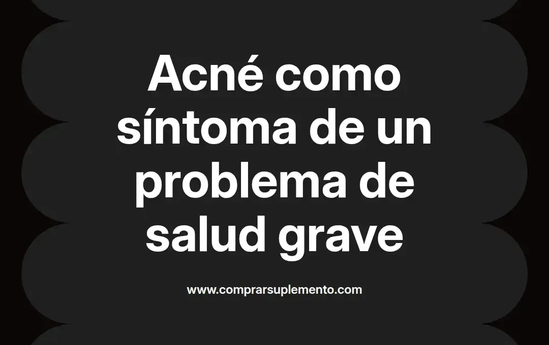 imagen destacada del post con un texto en el centro que dice Acné como síntoma de un problema de salud grave y abajo del texto aparece el nombre del autor Omar Obando