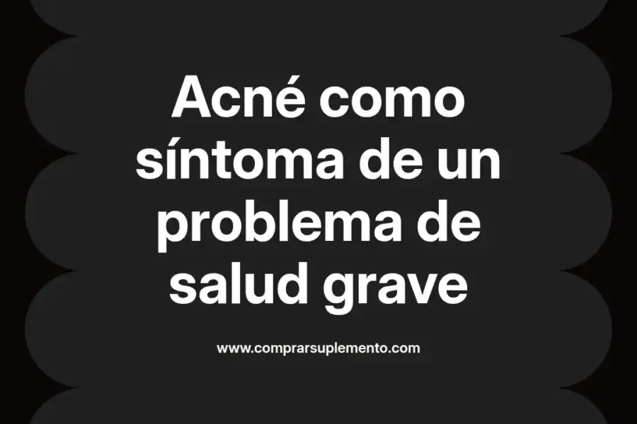imagen destacada del post con un texto en el centro que dice Acné como síntoma de un problema de salud grave y abajo del texto aparece el nombre del autor Omar Obando