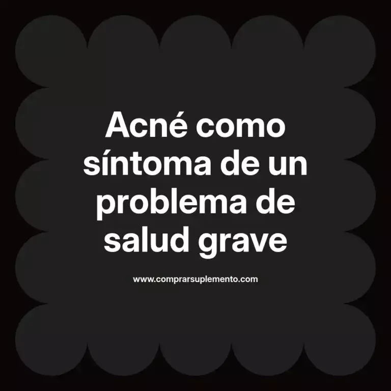imagen destacada del post con un texto en el centro que dice Acné como síntoma de un problema de salud grave y abajo del texto aparece el nombre del autor Omar Obando