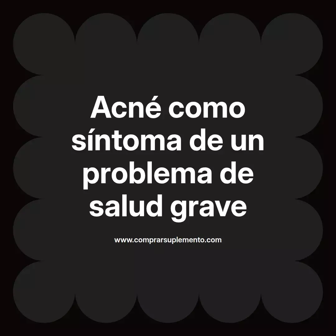 Acné como síntoma de un problema de salud grave